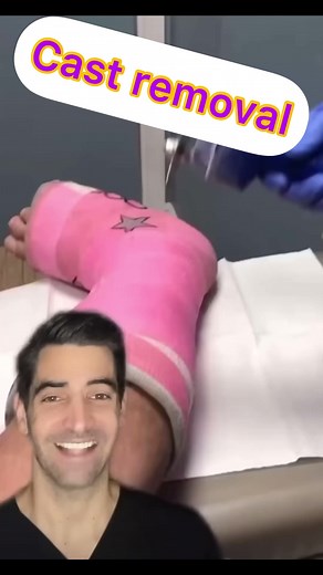 143K views · 333 reactions | Cast removal… wait to see what’s inside of it 冷冷冷 | Joyful Journey | Facebook