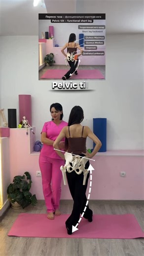 verginia center on Instagram: "Pelvic tilt & functional short leg correction Asymmetric lunges help to align the pelvis, activate gluteal muscles and restore body symmetry. The short leg is placed backward to stabilize the pelvis and normalize movement. Exercise: 10 reps × 3 sets Asymmetric Method by Dr. Marina Ispiryan 📩 WhatsApp: +37498149914 🌍 Website: Verginia.com #pelvictilt #unevenhips #shortleg #asymmetrictraining #posturecorrection scoliosiscorrection rehabilitation physiotherapy spine
