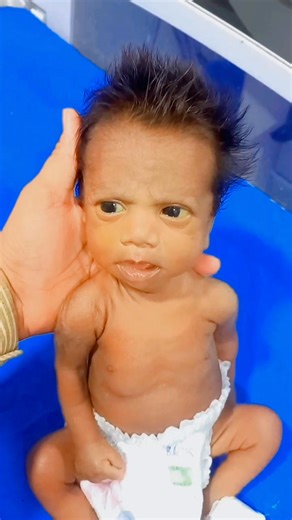 Baby flexibility test #trending #baby #newbornbaby #viralvideo #babycare #fbviralpost2025シ #trandingshorts #medicalstudent #shorts #fbpost | Gautam Ashish