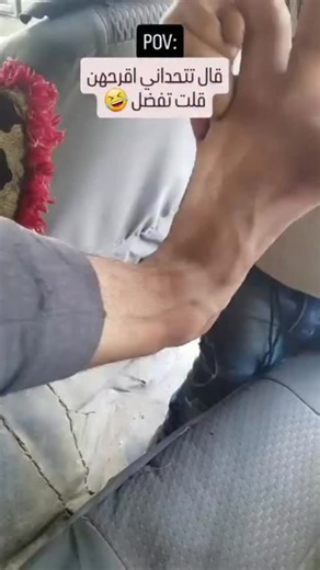 Dr. Chad on Instagram: "Congenital macrodactyly is a rare condition where one or more fingers or toes are abnormally large from birth. 🖐️🦶 It happens due to overgrowth of bone, fat, nerves, and soft tissue—often affecting a single digit and usually on one side of the body. The enlarged digit may grow faster than the rest of the hand or foot, becoming more pronounced over time. While it’s typically not life-threatening, macrodactyly can impact function, mobility, and self-image. Treatment is hi