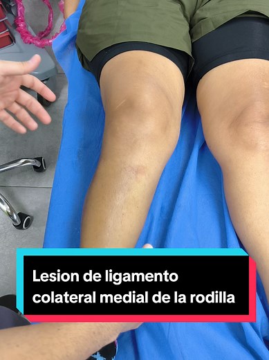 Lesión de ligamento colateral medial de la rodilla: cirugía
