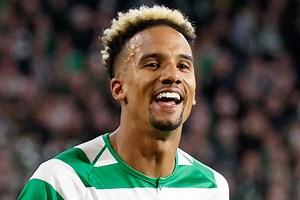 Sinclair shares huge montage for milestone and ex-Celtic pals say the same thing