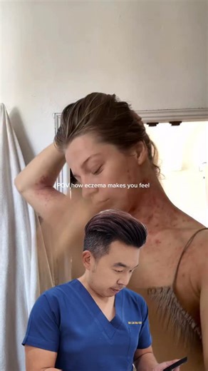 How to control eczema itchiness effectively 👇🏻 -Moisturize often with thick, fragrance-free creams, especially after bathing to lock in moisture -Take lukewarm showers, avoid hot water which dries out skin and worsens itching -Apply cold compresses or ice packs to soothe and reduce itch intensity -Pinch and pat itchy skin instead of scratching to prevent irritation and scarring -Wear soft, breathable, natural fabrics and use gentle detergents to avoid irritation -Consider wet wrap therapy for 