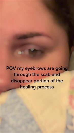 Understanding the Healing Process After Microblading