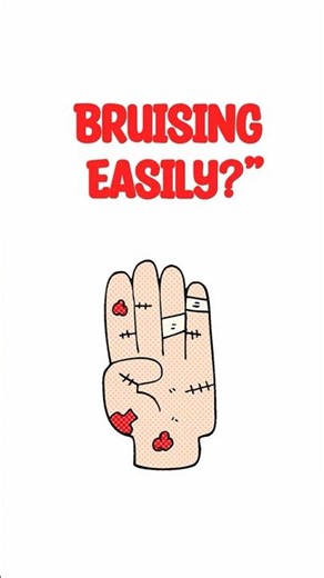 Bruising Easily? Your Body Might Be Trying to Tell You This