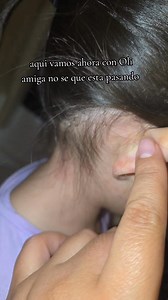 Y tmbn todas sus piernitas 😲 #sick #alergias #OMG #enferma | MI Familia De 5