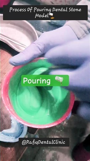 Pouring Dental Stone Model🫗 #dentalclinic #dentallab #dentist #dentalartistry #teeth #dentist #tips