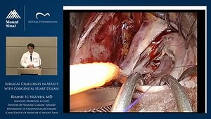 Surgical Challenges in Adults with Congenital Heart Disease