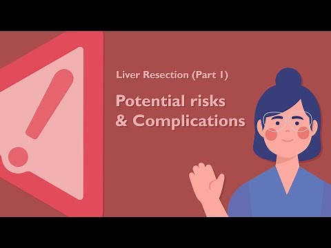 Risks and Complications of Liver Resection Surgery | TVASurg Patient Learning