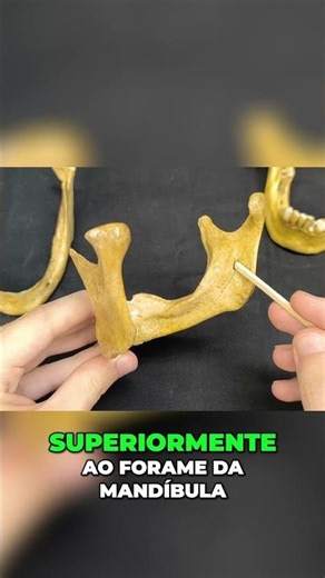 Mandíbula: Linha Milo-Hióidea, Língula e Ligamento Esfenomandibular.