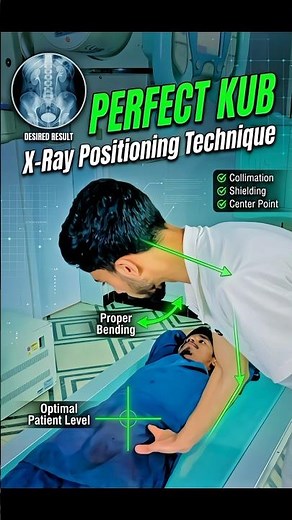 KUB xray positioning Technique #drnakash2001