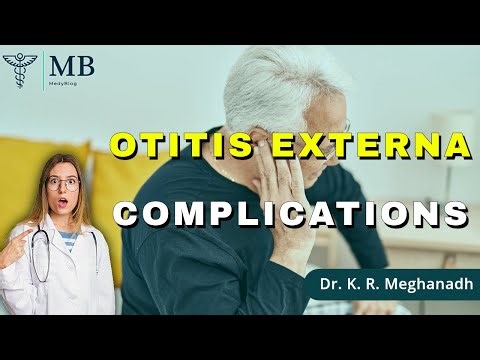 What Are the Complications of Otitis Externa?| Dr. K. R. Meghanadh | Medyblog