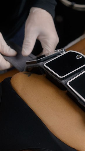 InMode Belgium | Looking to expand your treatment offerings? Discover how the combination of InMode IgniteRF and EvolveX can help target fat reduction,... | Instagram