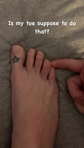 5K views · 63 reactions | When your toe malfunctions | LifeOfADoctor | Facebook