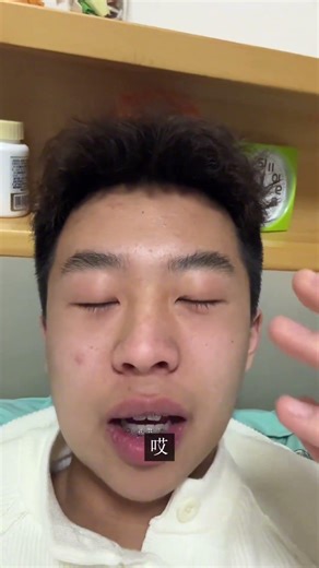 Day 3 Post-Wisdom Tooth Extraction: Ortho Journey Unveiled