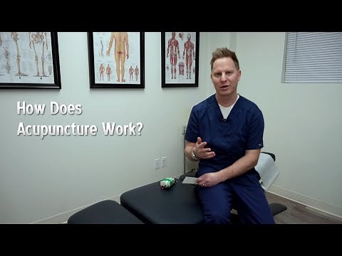 How Does Acupuncture Work? By Dr. Charles - Toronto Chiropractor