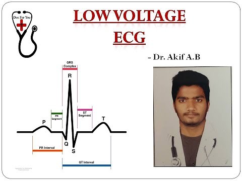 Low Voltage ECG - Dr. Akif Baig