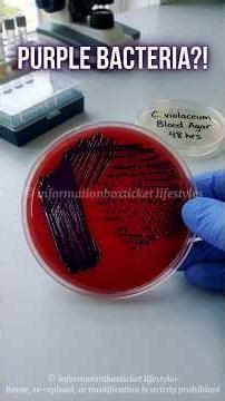 Chromobacterium violaceum on Blood Agar | Purple Colonies Explained #microbiology #labdiagnosis