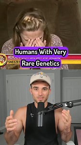 Humans With Very Rare Genetics #humans #superpower #rare #genetics #body #education #fun #sambucha | Sambucha