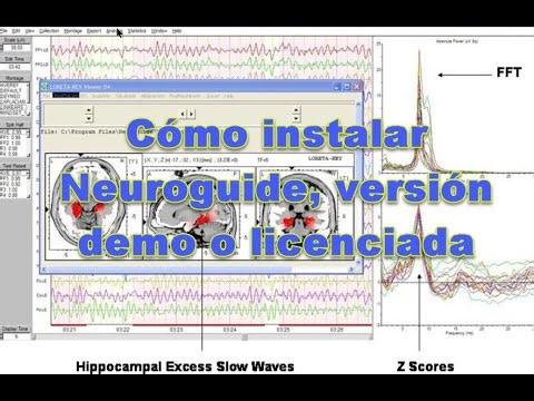 Cómo instalar Neuroguide, versión demo o licenciada
