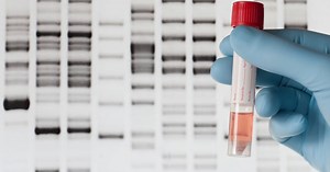 Tout savoir sur les tests ADN en ligne