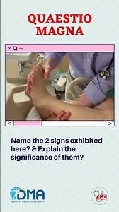 Hyperreflexia | OSPE & OSCE | MBBS | NEXT | | PLAB | USMLE | DMA