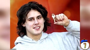 9 Weirdest Things People Have Swallowed