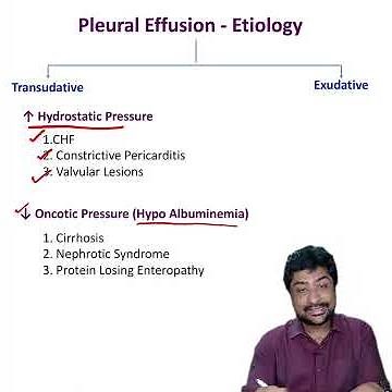 Quick Guide to Pleural Effusion: Types, Causes & More in Just 2 Minutes! [NeXTPG | NEE PG | INICET ]