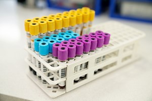 Proteína C Reativa (PCR): o que é, para que serve e quando fazer o exame | CNN Brasil