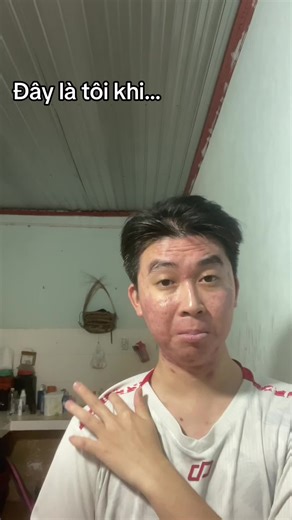 Nghe bảo lấy vợ là hết mụn, vậy thì 100K Follow tui lấy vợ liền, làm chuột bạch xem có hết mụn không nhé, Việt Nam nói là làm :)))) #leannhien #tamtrang #mun