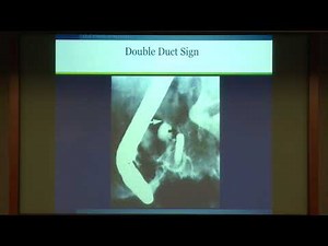 Biliary Drainage for Pancreatic Malignancy: Options and Timing