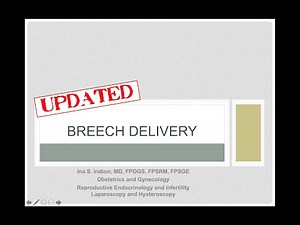 Breech vaginal delivery