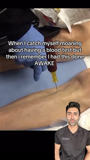 Kunal Sood, MD on Instagram: "When IV access isn’t an option, intraosseous (IO) access provides a fast and reliable way to deliver fluids and medications in emergencies. It’s often used in cardiac arrest, shock, and severe trauma. 🚑 Have you ever seen this in action? #medical #health VC: @knfecrimekay"