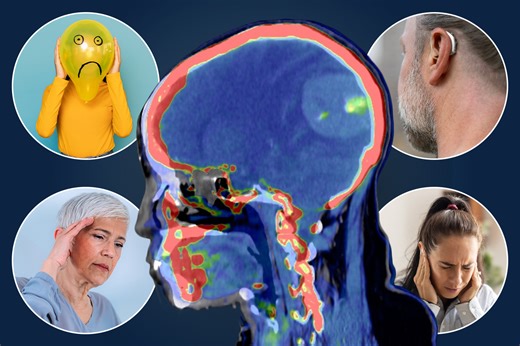 Anxiety and 8 other symptoms could be signs of an 'acoustic' brain tumour