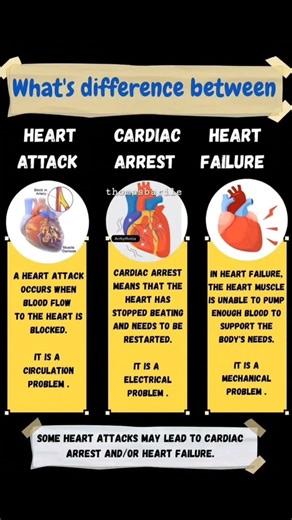 what's difference between heart attack, cardiac arrest and heart failure #cardiacsafety #safeheart
