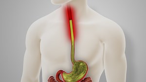 Side effect of stopping omeprazole as NHS issues warning over use