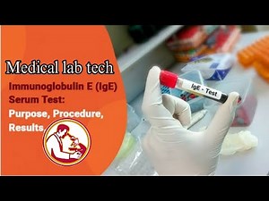 How to perform Total Ige test in ichroma ll