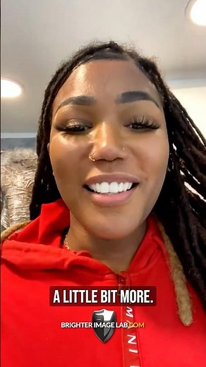 Can Affordable Veneers Really Boost Your Confidence?