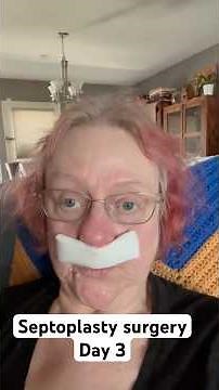 Septoplasty surgery: DAY 3