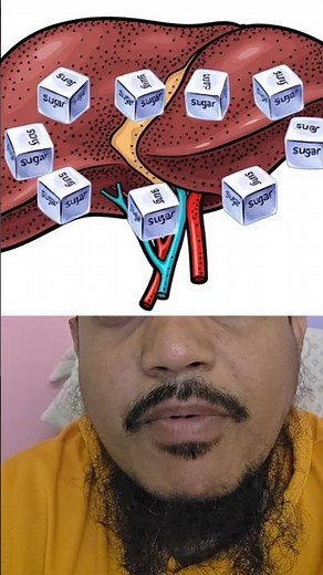 How Stress ACTUALLY Causes Diabetes