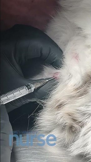 Aspiration Technique for Collecting Fine-Needle Aspirate