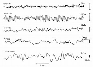 DIY EEG (and ECG) Circuit