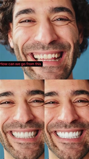 Realistic AI image generation for dentists… Do you ever struggle to help patients visualize the final result for veneers or implants? Our dentists reported a significant increase on veneers and implant conversions. #smilemakeover #veneers #dentalimplants #dentist