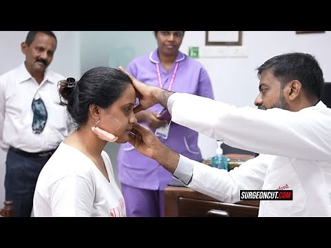 Jaw Surgery Amazing Transformation - Complete Follow up - Before & After