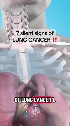 7 Silent Signs of Lung Cancer You Shouldn't Ignore