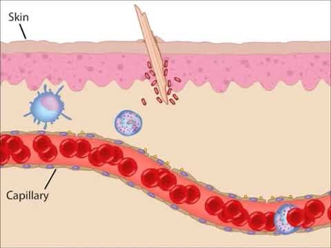 Respuesta Inflamatoria Básica