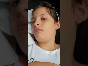 Seizure - complex partial with secondary generalization + Buccolam.