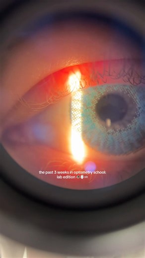 Exploring Optometry Labs: A Student's Journey