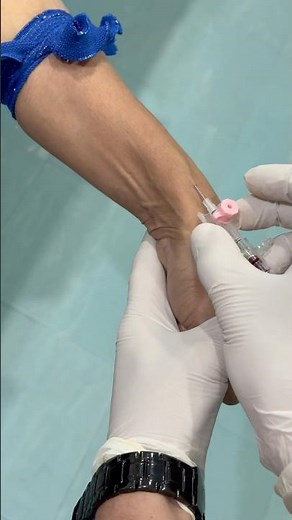 How to Pass a 20-Gauge IV Line in CT Triphasic Scan – Importance of a Large Bore IV#education #short