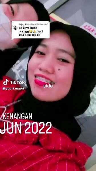 Replying to @imaberlian Msih prosess kurleb 3thn tpi alhamdulillah worth the price hihi #braces #behelgigi #bracesjourney #fyp #fypシ゚ #xybca